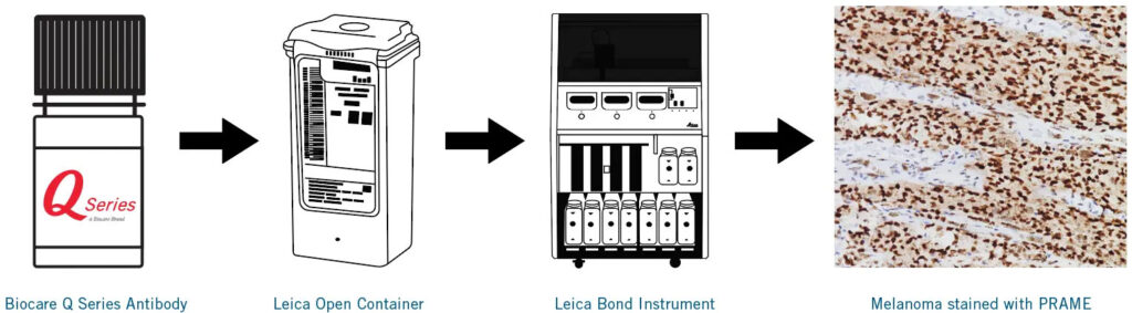 Biocare’s Q Series – Ready to Use Antibodies for Leica Bond