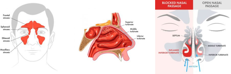 Why The Breathing Triangle?